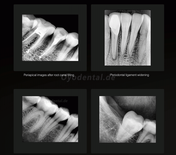 Runyes DR730 Dental Digitaler Röntgensensor Intraorales Sensorbildsystem